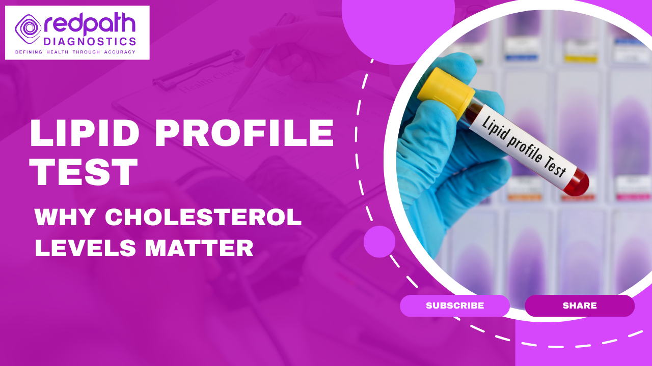 Lipid Profile Test: Why Cholesterol Levels Matter