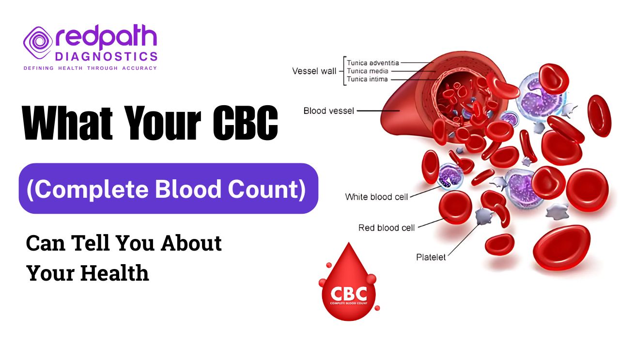 What Your CBC (Complete Blood Count) Can Tell You About Your Health