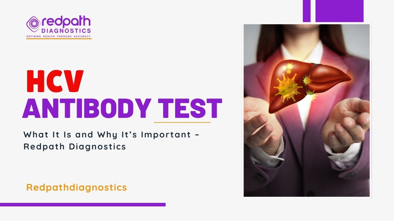 HCV Antibody Test: What It Is and Why It’s Important – Redpath Diagnostics
