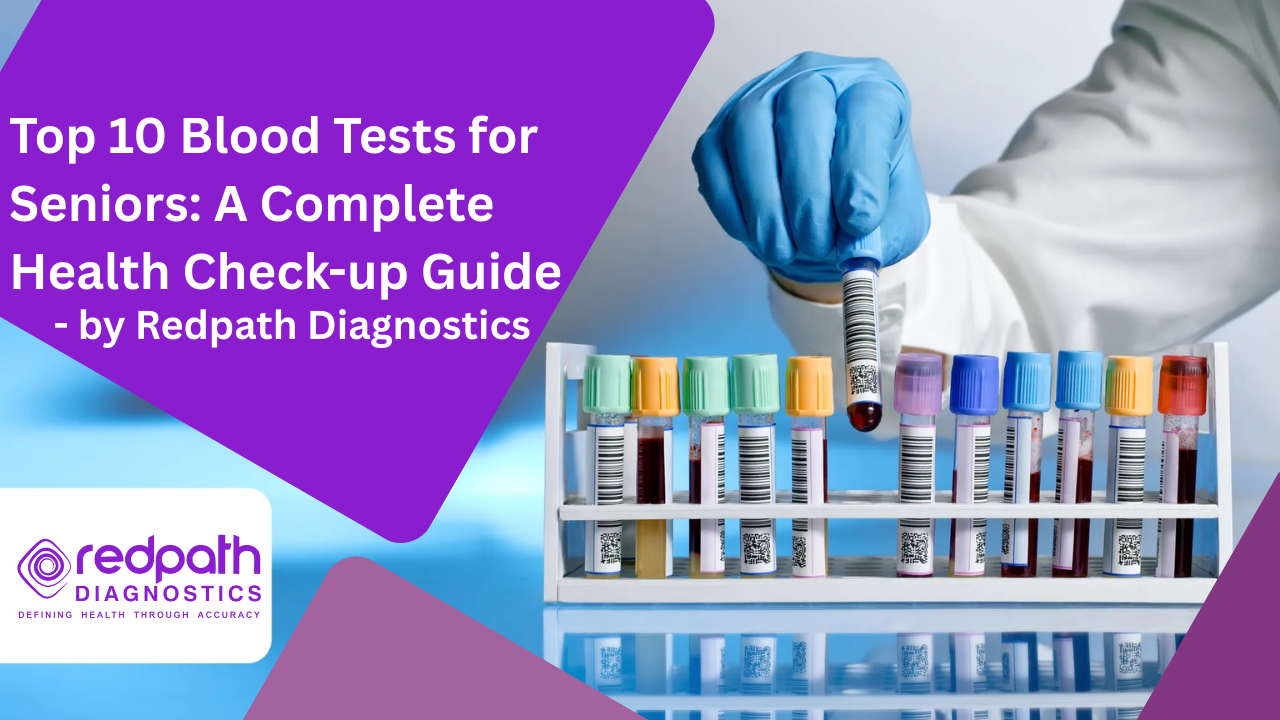 Top 10 Blood Tests for Seniors: A Complete Health Check-up Guide