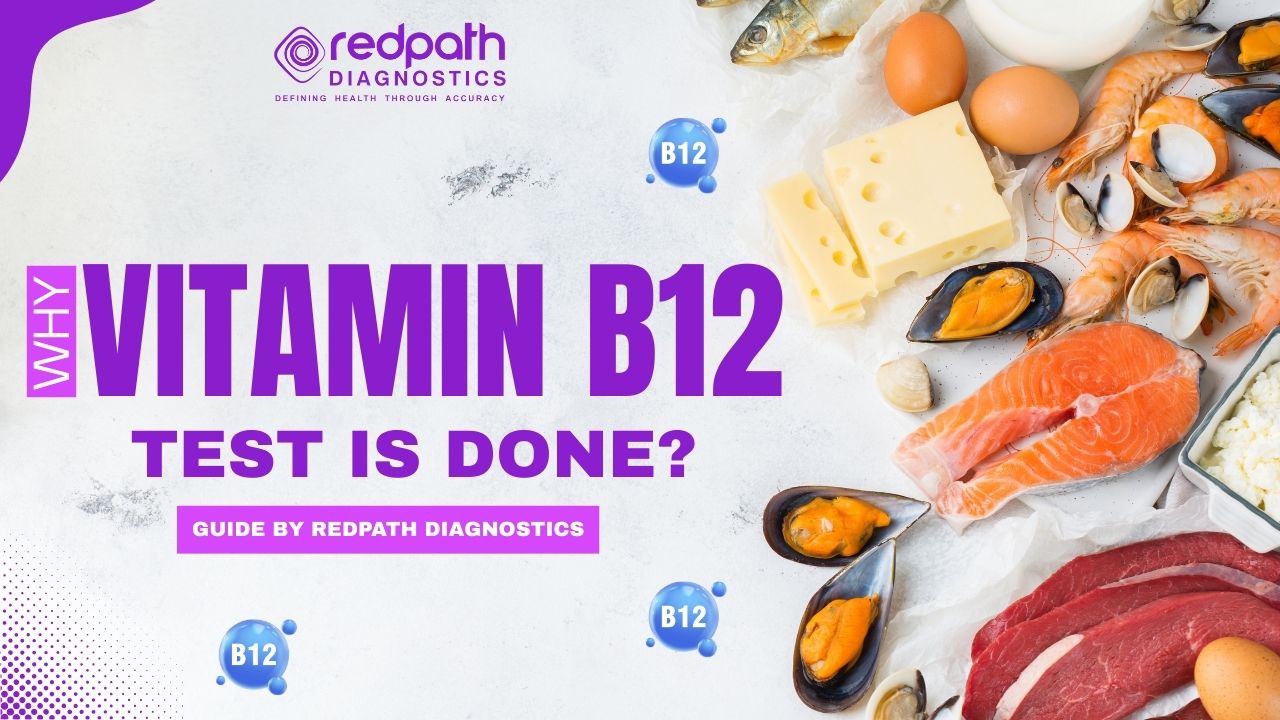 Why vitamin B12 test is Done? Guide by Redpath Diagnostics