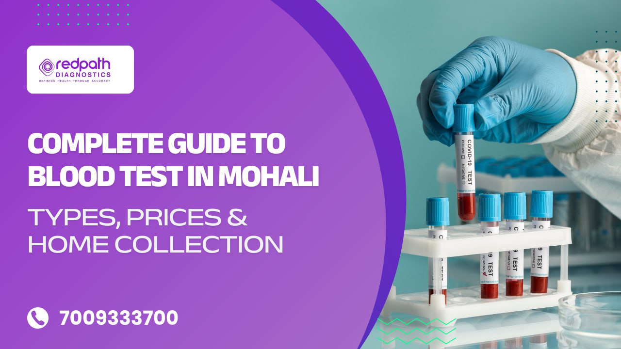 Complete Guide to Blood Test in Mohali: Types, Prices & Home Collection